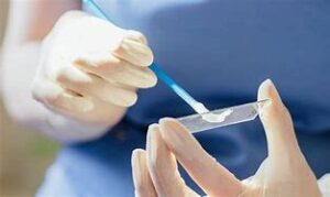 Анализы на уреаплазму в Майами