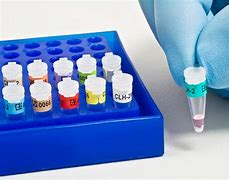 Анализы на уреаплазму в Майами