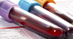 Анализы на уреаплазму в Майами