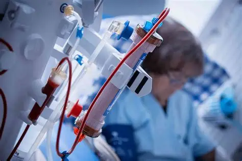 гемодиализ