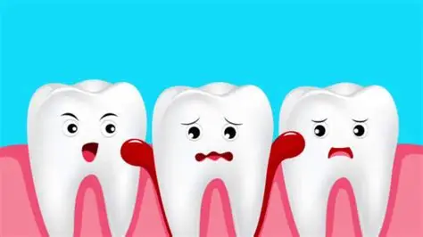 заболевания зубов