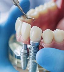 Стоматологическая страховка